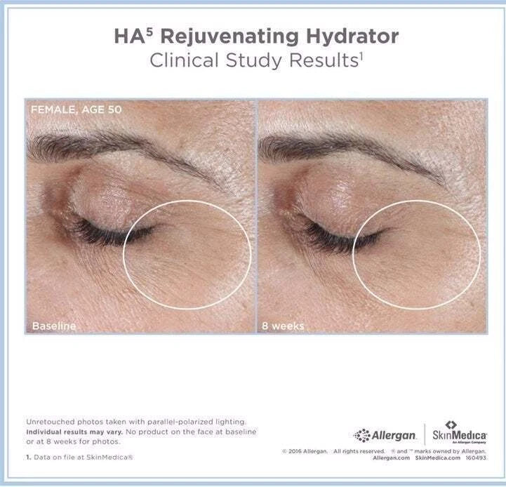 SkinMedica HA5 Rejuvenating Hydrator – 2 oz, New & Sealed
